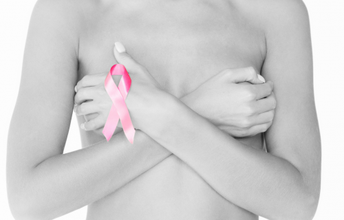 Best Vaginal Rejuvenation for Breast Cancer Survivors