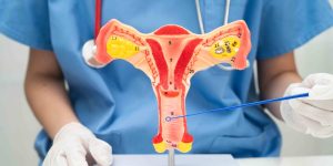 Managing Vaginal Dryness and Pain After Menopause