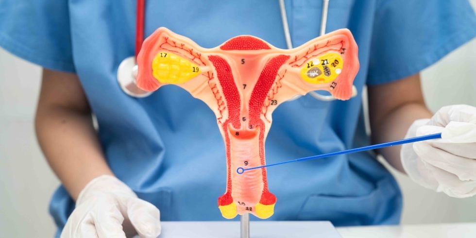 Managing Vaginal Dryness and Pain After Menopause